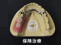 保険治療